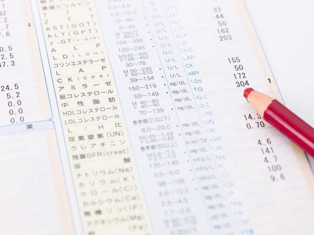 健康診断の検査結果の画像│神戸市北区で健康診断が安い、押谷クリニック