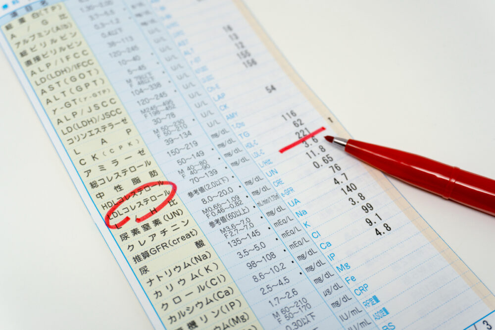 健康診断でひっかかる「要再検査・要精密検査」って何？神戸市北区の内科「押谷クリニック」